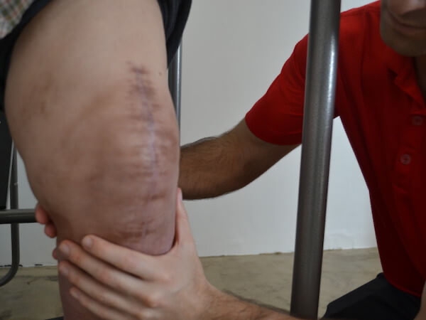 10 Steps in the injury recovery process - SoCal Elite Physical Therapy